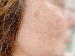 毎日パックした結果 50代の肌