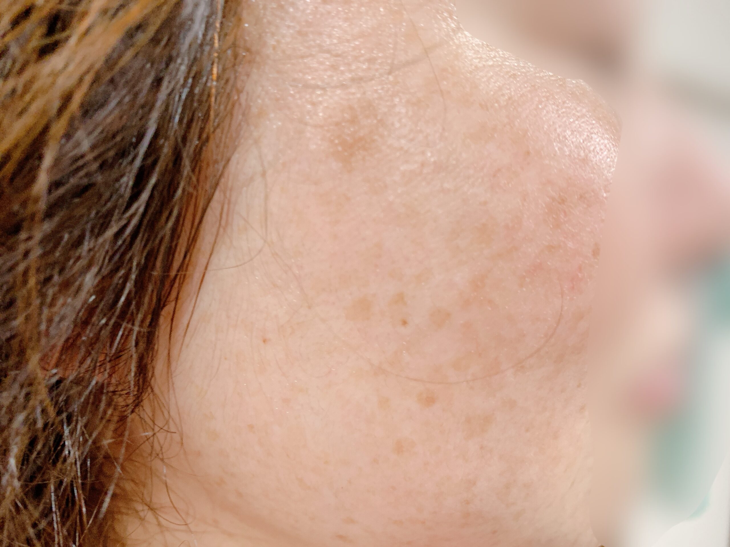 毎日パックした結果 50代の肌